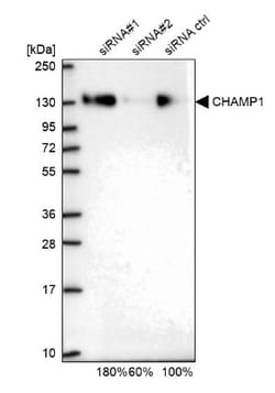ZNF828 Antibody, Novus Biologicals 25 &mu;L; Unlabeled:Antibodies, Polyclonal